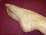 foot